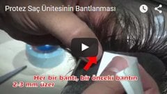 Protez Saç Ünitesinin Bantlanması